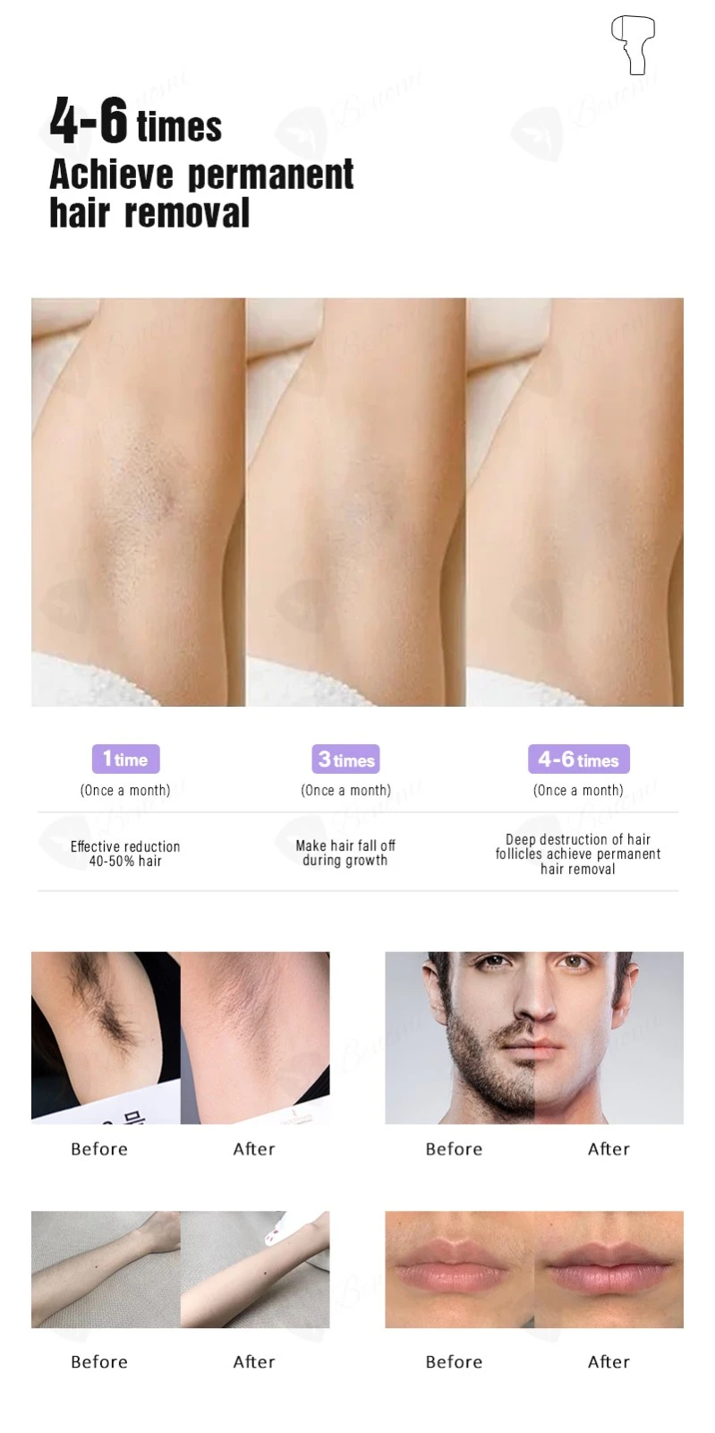 Diode Laser Hair Removal Device: A New Experience Of Hair Removal